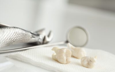 Wisdom Tooth Removal or Childbirth: Which Is More Painful?